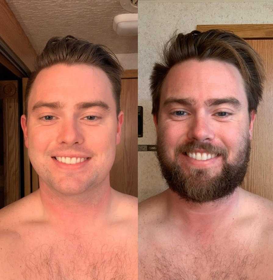 Сколько отрастают волосы у мужчин. Мужчина без бороды. Отращивание бороды. Отращивание бороды до после. Борода до и после.